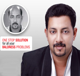 Hair Restoration